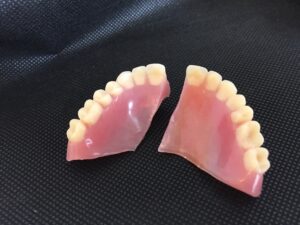 Denture plate cracked